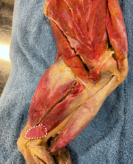 <p>Identify the muscle</p>