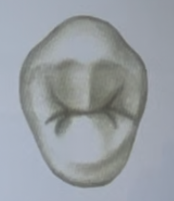 <p>Maxillary right first premolar, maxillary right second premolar, mandibular right first premolar, mandibular right second premolar</p>