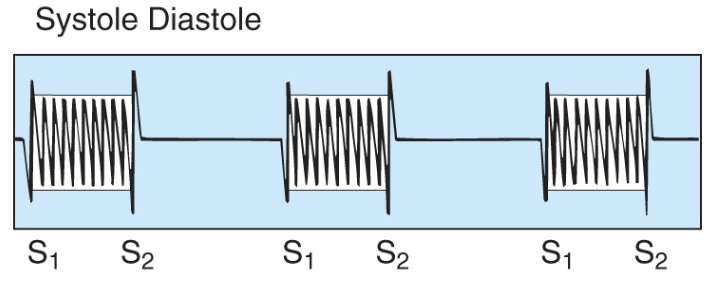 <ul><li><p><span style="background-color: transparent;">Heard during the entire systolic or diastolic period</span></p></li><li><p><span style="background-color: transparent;">May obscure S<sub>1</sub> or S<sub>2</sub></span></p></li><li><p><span style="background-color: transparent;"><sub>longer</sub></span></p></li></ul><p></p>