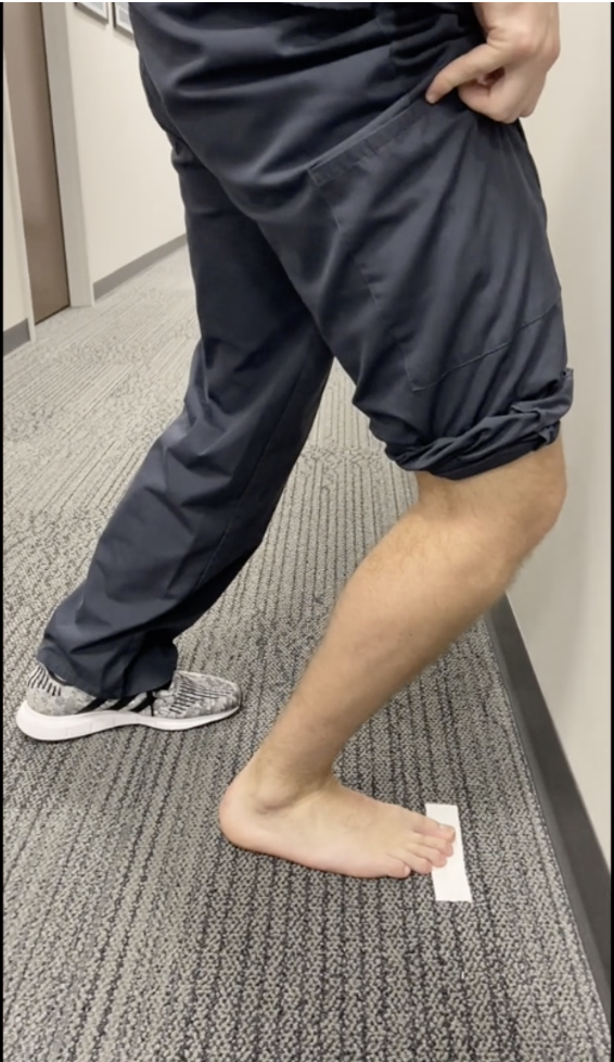 <p><strong>Purpose</strong></p><ul><li><p><span style="color: red;"><strong>Assess weight-bearing ankle DF ROM</strong></span></p></li></ul><p></p><p><strong>How to Perform</strong></p><ol><li><p>Mark <strong>10 cm</strong> from a wall using tape</p></li><li><p>Align the foot so an imaginary line through the heel and great toe points toward the wall</p></li><li><p>Lunge forward and attempt to touch the knee to the wall while keeping the heel on the floor</p></li></ol><p></p><p><strong>Positive Test</strong></p><ul><li><p><span style="color: red;"><strong>Failure to touch the knee to the wall from 10 cm → restricted DF / ankle stiffness</strong></span></p><ul><li><p>May reflect decreased joint mobility or soleus tightness</p></li></ul></li></ul><p></p>