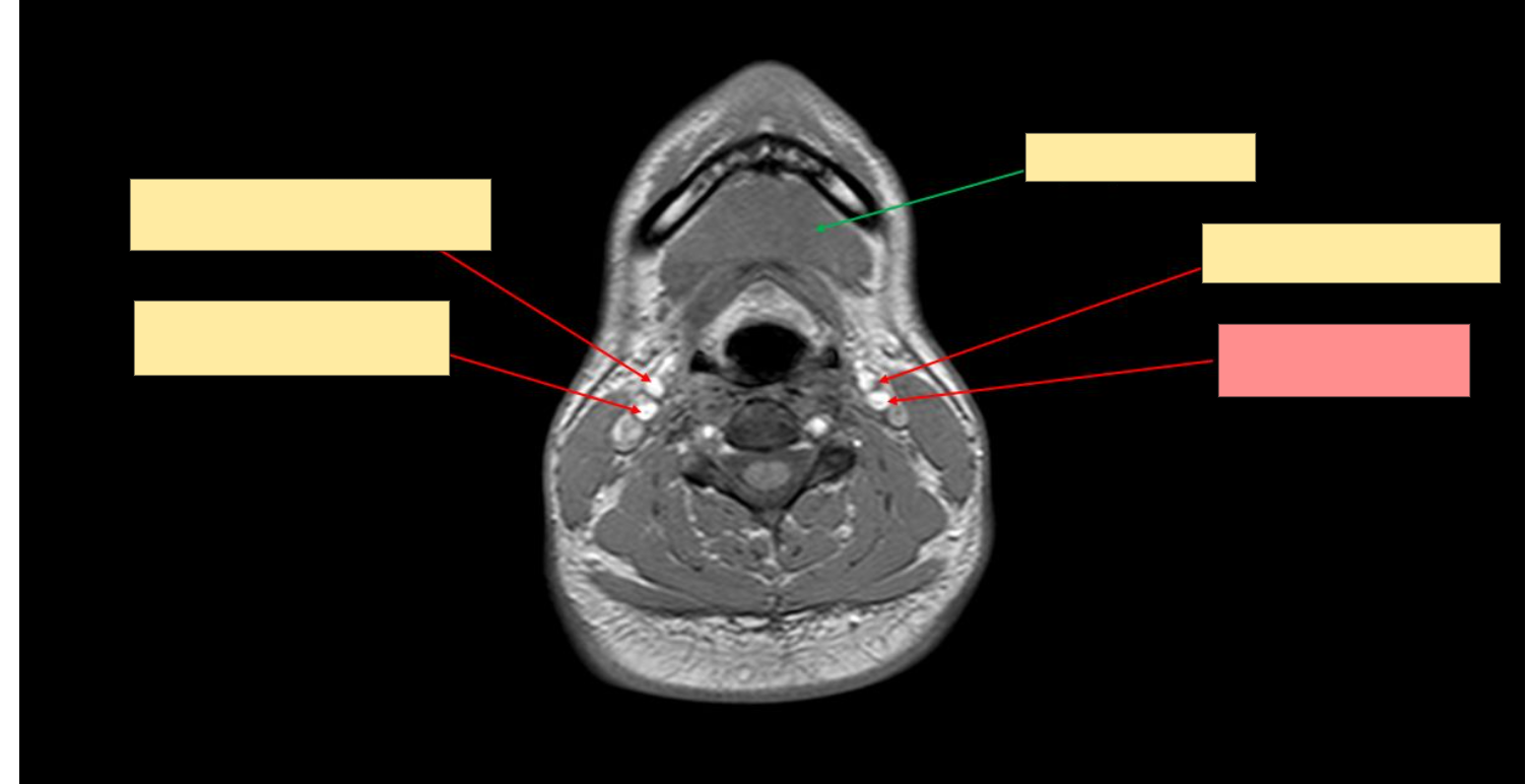 <p>Name this structure</p>