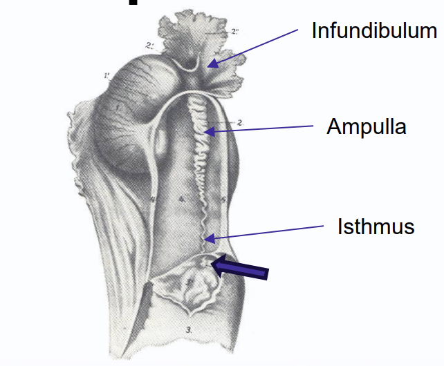 <p>infundibulum, ampulla, isthmus(blue arrow)</p><p></p>