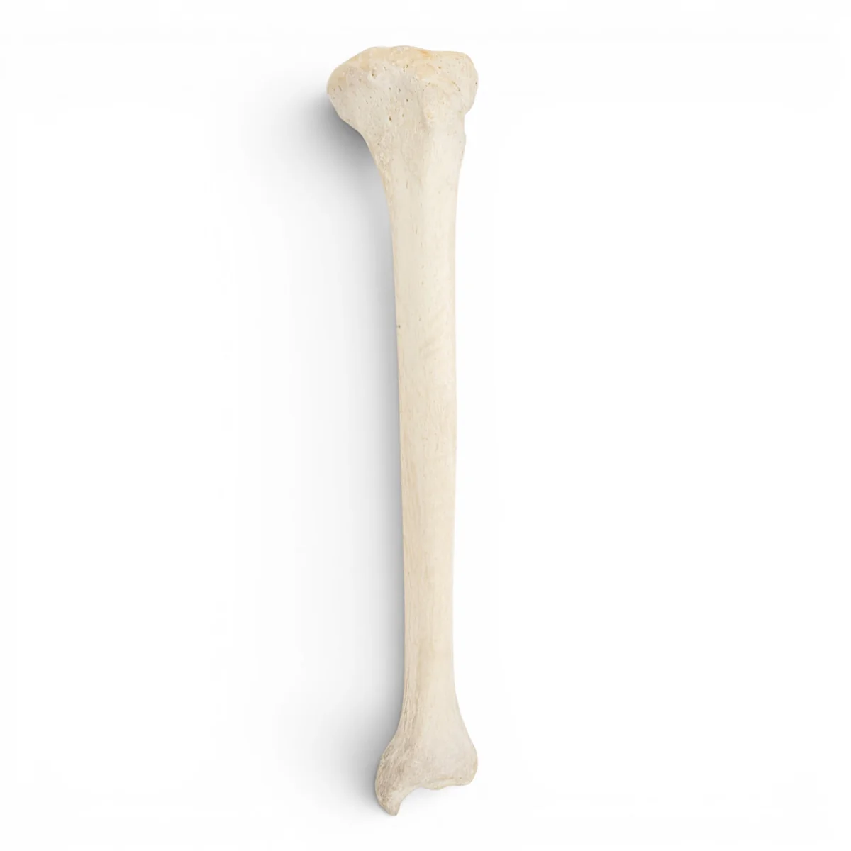 <p>What bone is this?</p>
