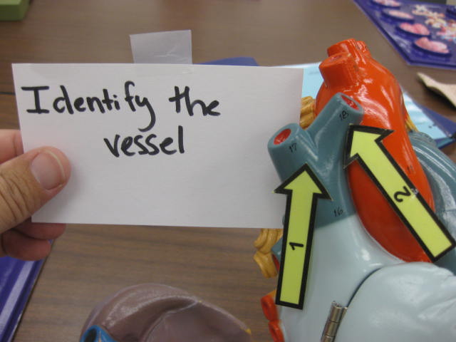 <p>Identify The Vessel 1 and 2?</p><p>Lab Image 3-4</p>