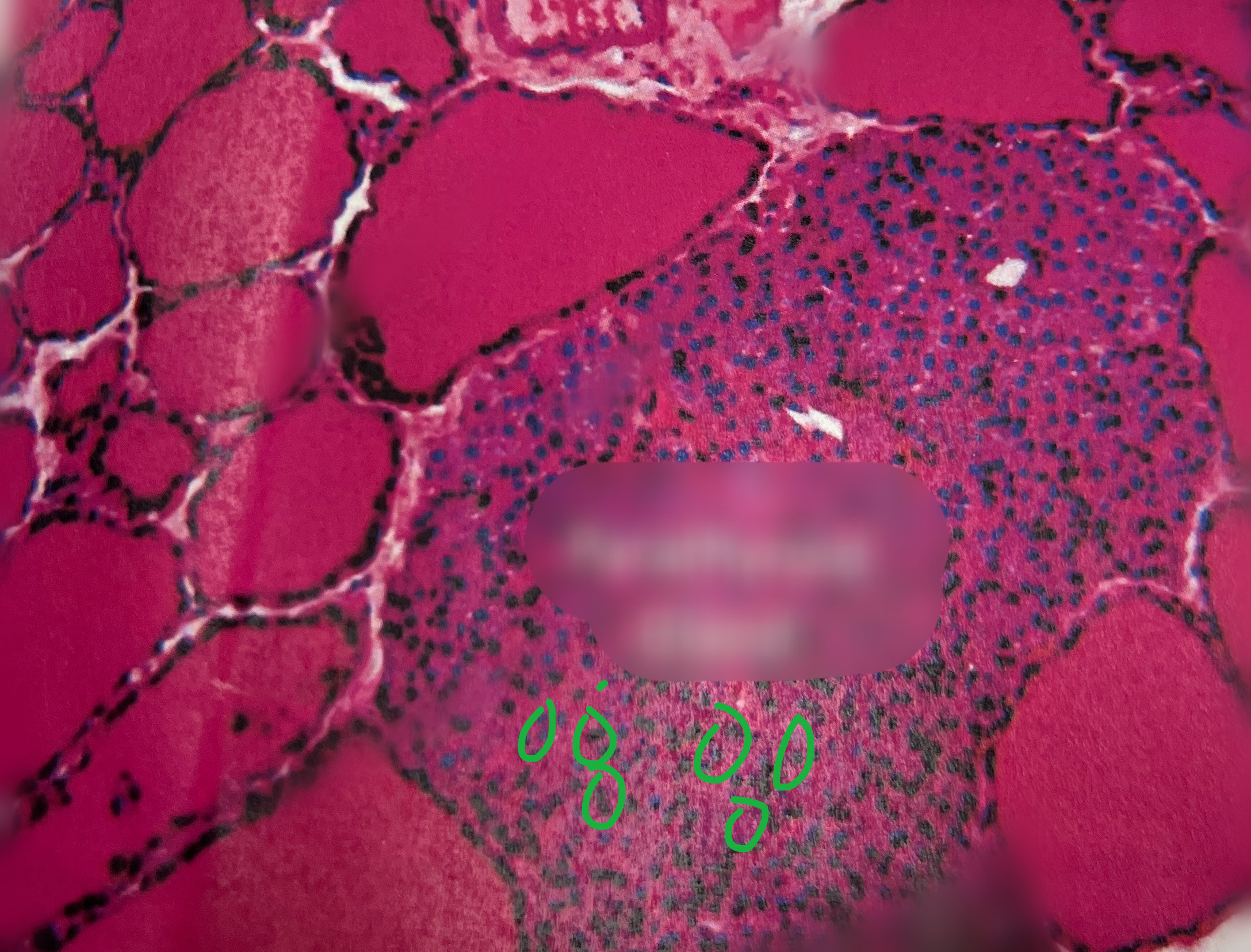 <p>What are the dots in the parathyroid gland known as?</p>