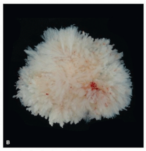 <p><span>Finger or nipple-like projections; small rounded protuberance on the body or an organ</span></p>