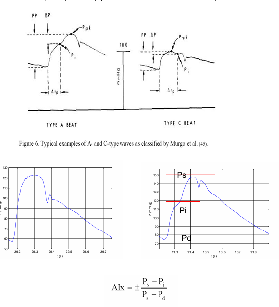 <p>AIx=Ps-Pi/PP</p><p></p><p>Where Ps is systolic pressure</p><p>Pi is pressure at the inflection point</p><p>PP is the pulse pressure (Ps-Pd, systolic pressure - diastolic pressure)</p>