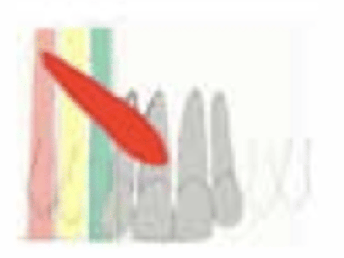 <p>What is the prognosis?</p><p>- Position of apex: Above 2nd premolar</p>