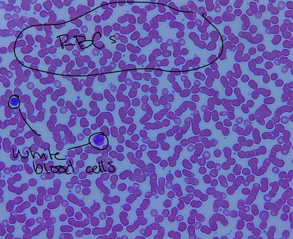 <p>Blood. Lots of red blood cells and some white in liquid plasma. RBCs transport gases, nutrients, wastes, and other substances throughout the body. Found in all blood vessels. White blood cells have a nucleus, but RBCs don’t. With the sole purpose of transporting oxygen, they don’t need a nucleus, and having them would make them much bigger and more difficult to flow through the body and pump through the heart. This is at the cost of them having very short half lives and no way to repair themselves if damage occurs. RBC production in bone marrow is constant.</p>