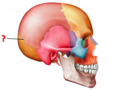 <p>Identify this suture.</p>