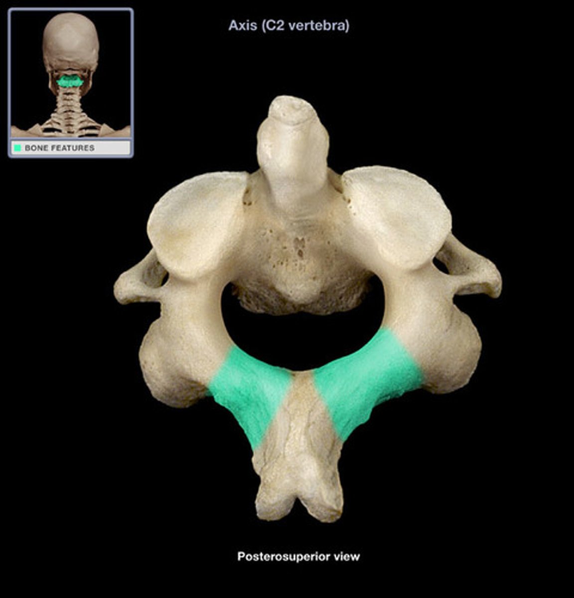 <p>On all vertebrae</p>