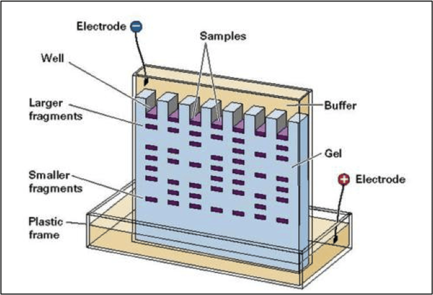 <p>method of separating serum proteins by electrical charge</p>