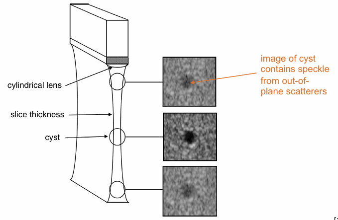 <p>out of plane artefacting → reflections from objects outside you slice → speckle </p>