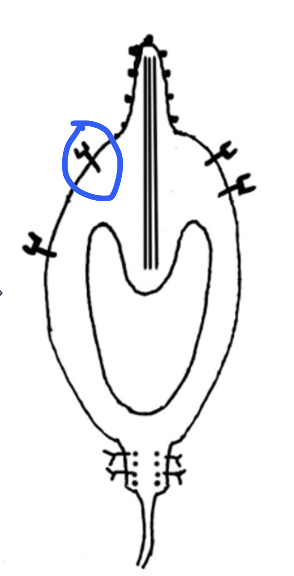 <p>What type of receptor is this?</p>
