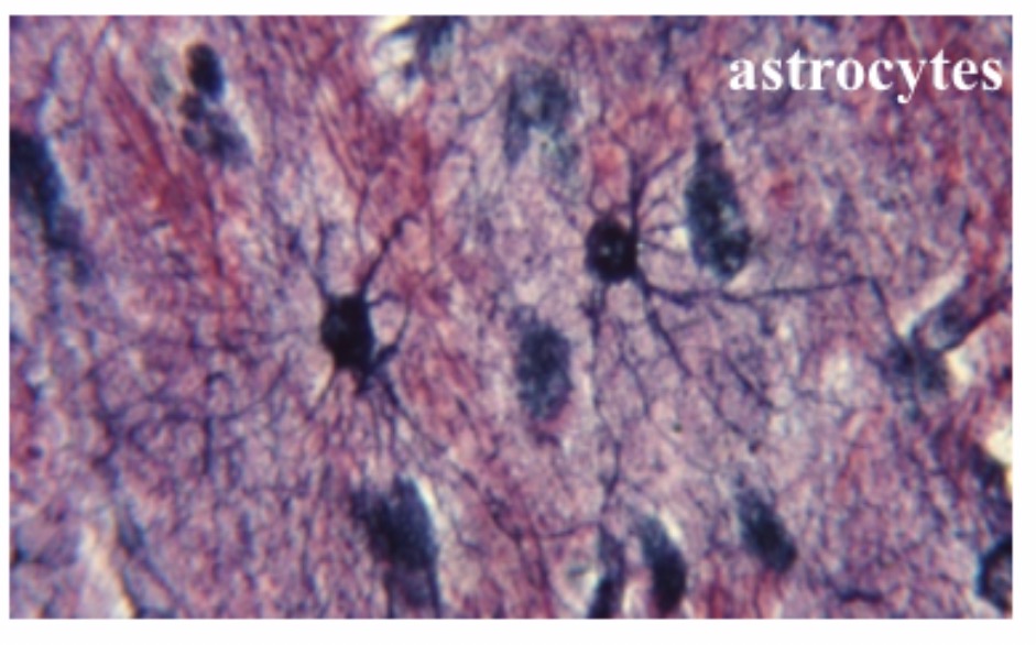 <p>Astrocyte</p>