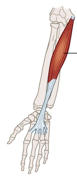 <p>What muscle is being shown? </p>