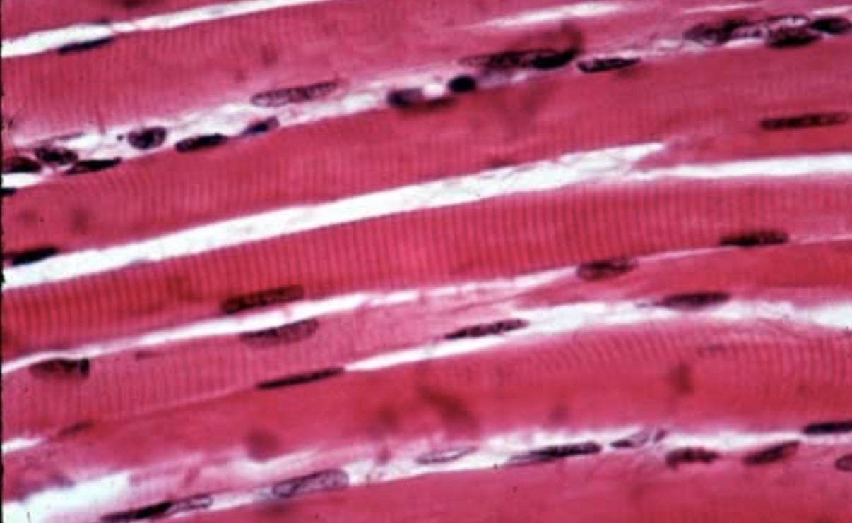 <p><span>Skeletal muscle tissue</span></p>