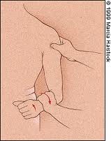 <p>pt in sitting with shoulder in neutral/stabilized against trunk, elbow flexed 90 deg and forearm pronated. PT places one hand on patient's forearm and other over bicipital groove. pt instructed to actively supinate and laterally rotate against resistance. (+) tendon of biceps long head will "pop out" of groove, (+) pain or tenderness in bicipital groove. Identifies bicipital tendonitis and integrity of transverse ligament.</p>