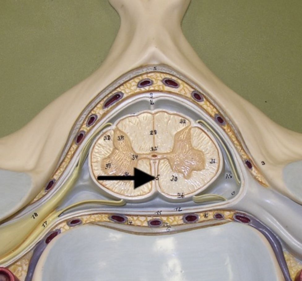 <p>deep indentation along anterior midline of spinal cord</p>
