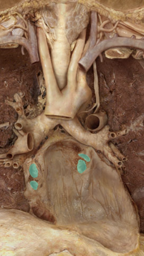 <p>Identify the feature of the heart</p>