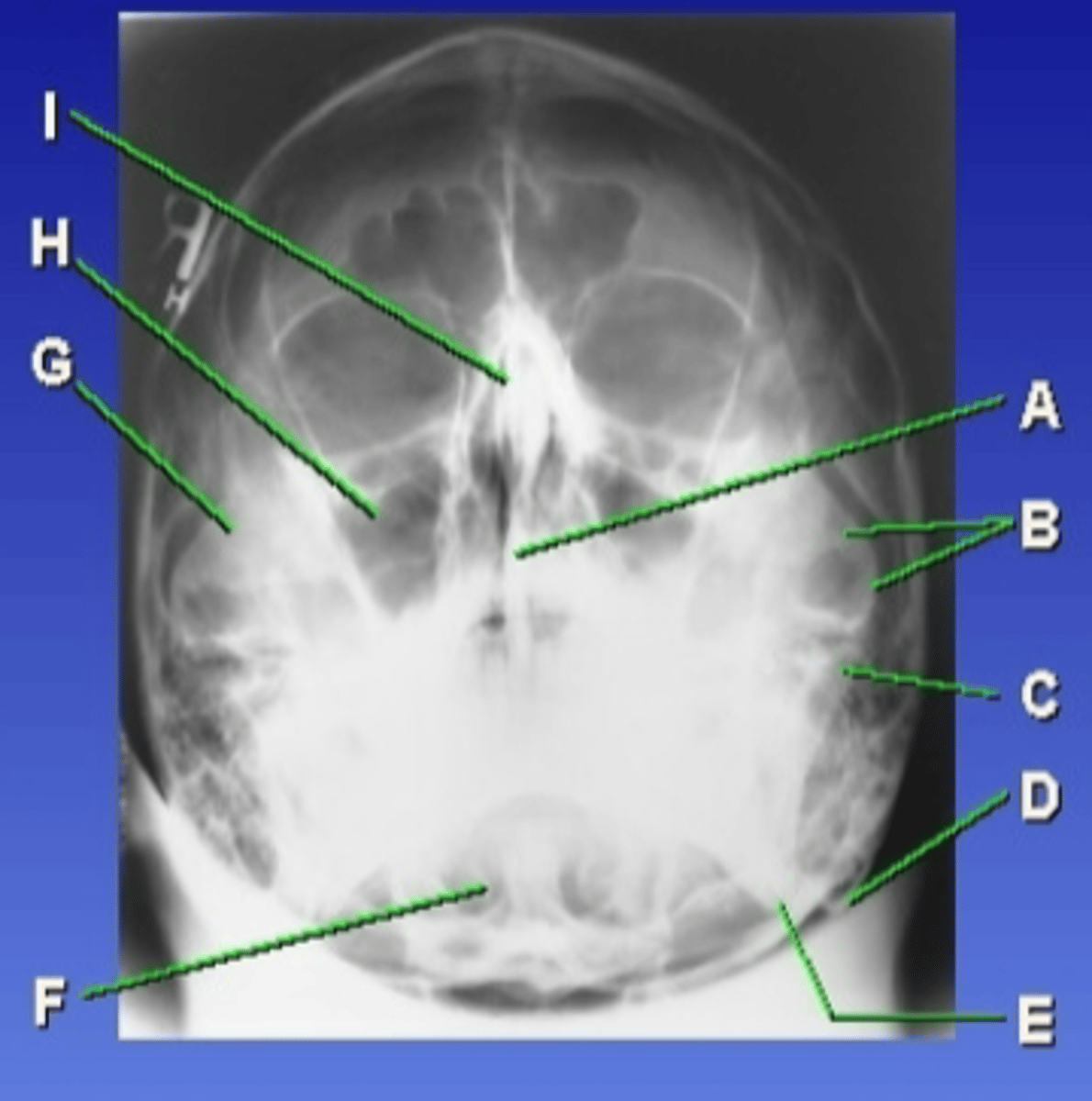 <p>A</p>