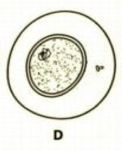 <p>What stage of mitosis is this?</p>