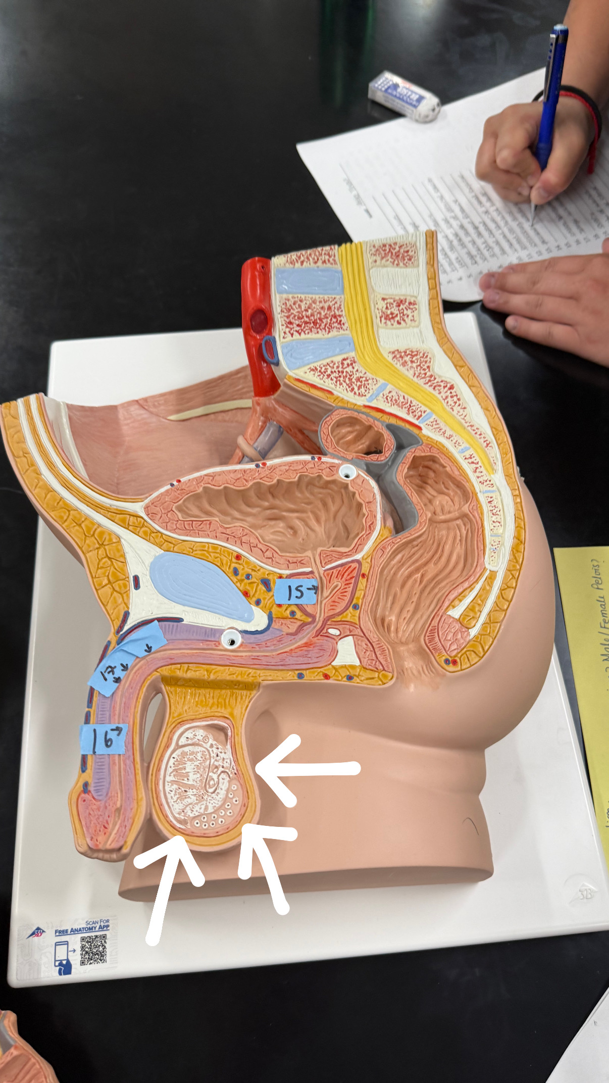 <p>yellow lining on balls, fat looking</p>