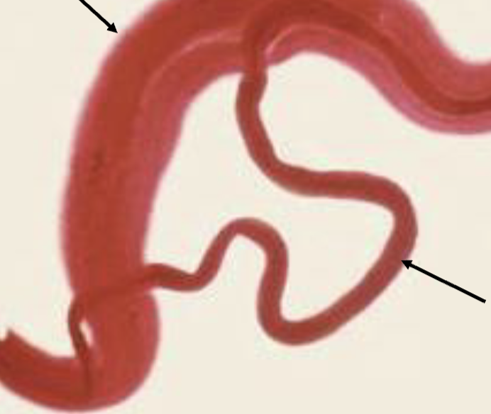 <p>top arrow is what</p>