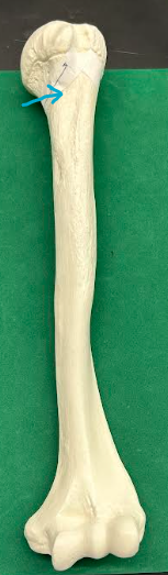 <p>ID humerus region </p>