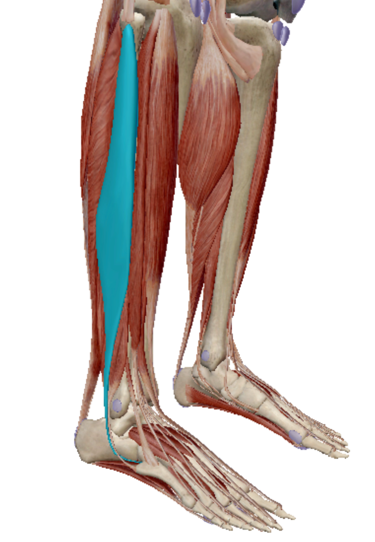<p>Identify the highlighted muscle. </p>