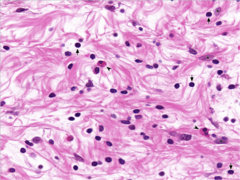 <p>Identify</p>