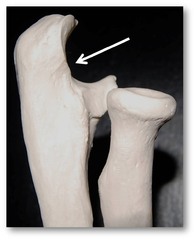 <p>the "swoop" of the "C"</p><p>Name this depression</p>