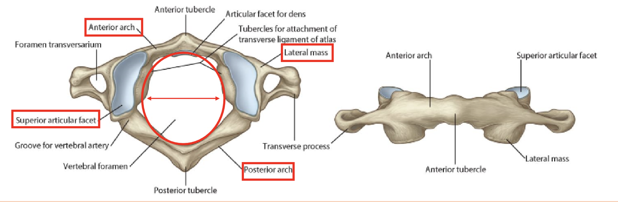 <p>C1= Atlas, nodding head yes"</p><p></p><ol><li><p>vertebral foramen</p></li><li><p>large superior articular facet</p></li><li><p>anterior arch</p></li><li><p>posterior arch</p></li><li><p>lateral mass</p></li><li><p>no vertebral body</p></li><li><p>no spinous process (allow for yes movement)</p></li></ol><p></p>