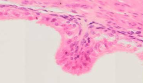 <p>naam epitheel </p>