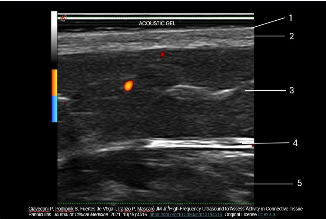 <p>Which number indicates the dermis layer of the skin?</p><p>A. 3</p><p>B. 2</p><p>C. 1</p><p>D. 4</p>