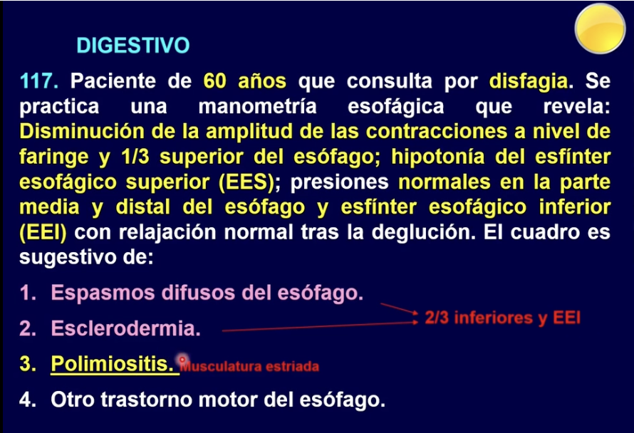 <p>1/3 superior—> estriado </p><p>2/3 inferiores—> liso </p>