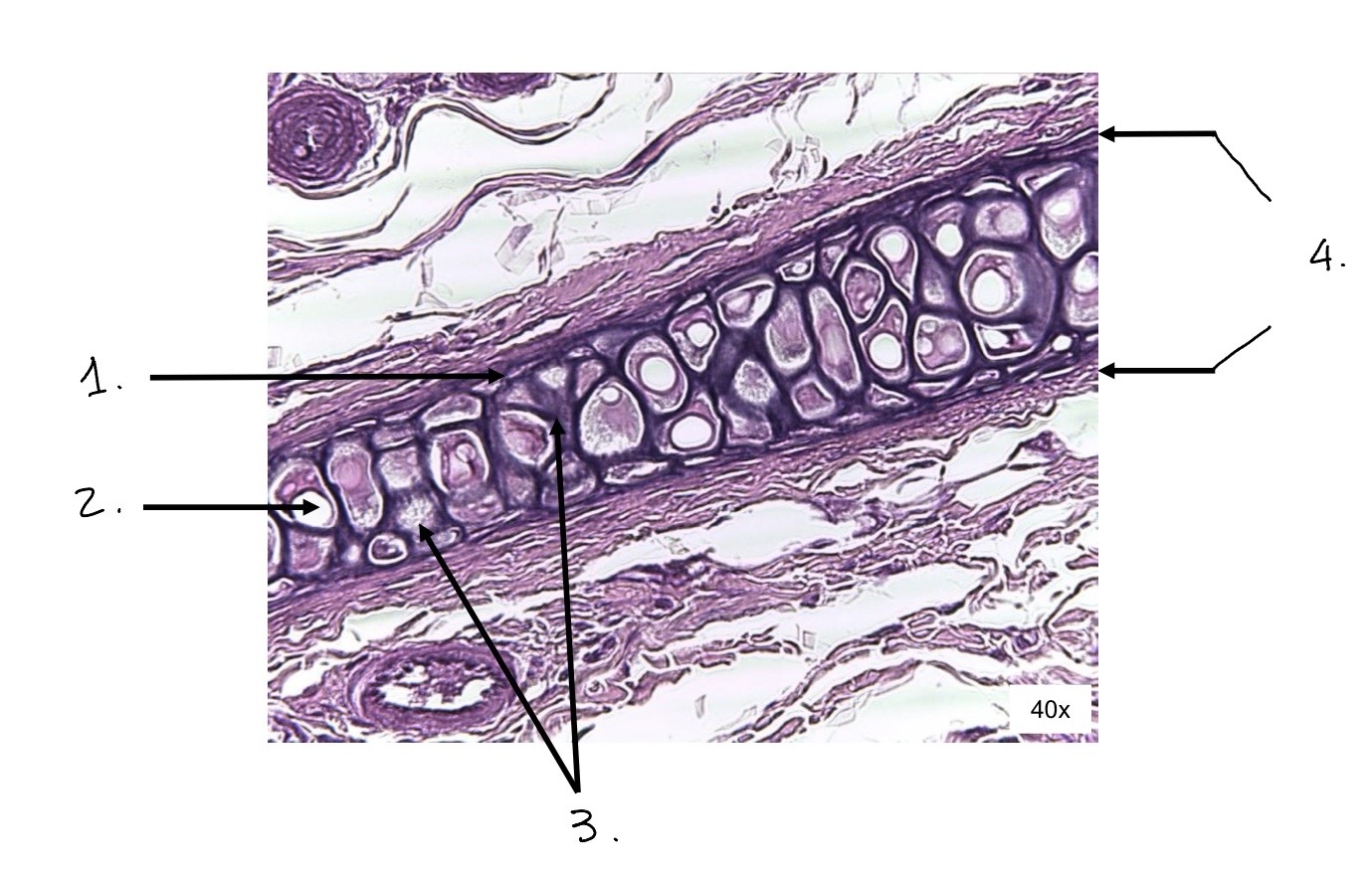 term image