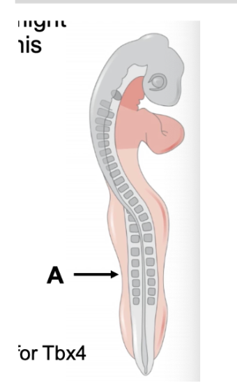 <p><span style="background-color: transparent;">Which of the following “move it” experiments might</span></p><p><span style="background-color: transparent;">result in an extra leg growing from point A in this</span></p><p><span style="background-color: transparent;">chick embryo?</span></p><p><br></p><p><span style="background-color: transparent;">A. Transplant an extra AER</span></p><p><span style="background-color: transparent;">B. Transplant leg mesenchyme</span></p><p><span style="background-color: transparent;">C. Insert a bead containing Fgf8</span></p><p><span style="background-color: transparent;">D. Insert a bead containing Fgf10</span></p><p><span style="background-color: transparent;">E. Insert a bead containing Fgf10 and an activator for Tbx4</span></p><p><span style="background-color: transparent;">F. Insert a bead containing Fgf10 and an activator for Tbx5</span></p>