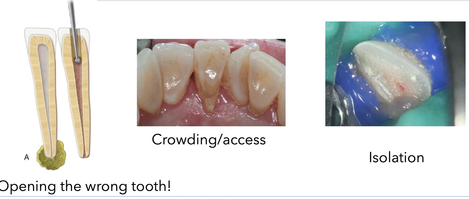 <ul><li><p>opening the wrong tooth </p></li><li><p>crowing/access </p></li><li><p>isolation </p></li></ul><p></p>