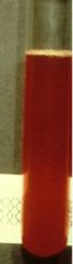 <p>Describe this joint fluid</p>