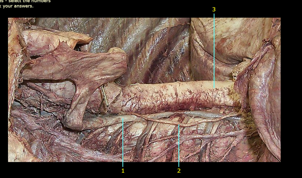 <p>What is 1 pointing to?</p>