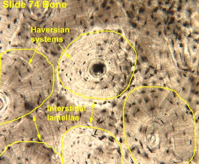 <p>Look for irregular remnants/fragments of lamellar bone between intact osteons. Unlike complete osteons, they lack a central canal.</p>