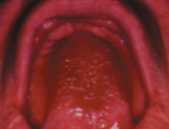 <p>what is this condition</p>