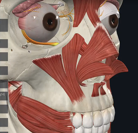 term image