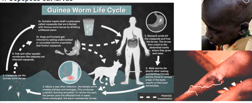 <p>endoparasite in phylum Nematoda</p><p>1) human ingests copepods with larvae in unfiltered H2O or undercooked fish</p><p>2) larvae burrow into stomach lining</p><p>3) female emerges from blister into H2O (~10-14 months after ingestion)</p><p>4) copepods eat larvae</p><p>may become the first non-viral parasite to be eradicated in humans</p><p>can host in dogs and other animals (previously thought to only host in humans and copepods)</p>