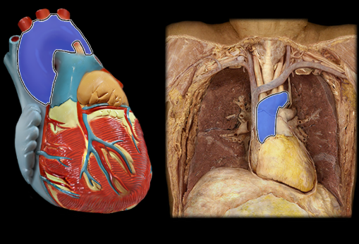 <p>oxygenated blood from the left ventricle is pumped into here</p>