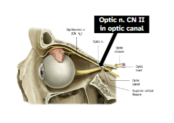 <p>Sensory fibers from retina for vision</p><p>Wrapped by meninges</p><p>Runs in optic canal with ophthalmic artery</p>