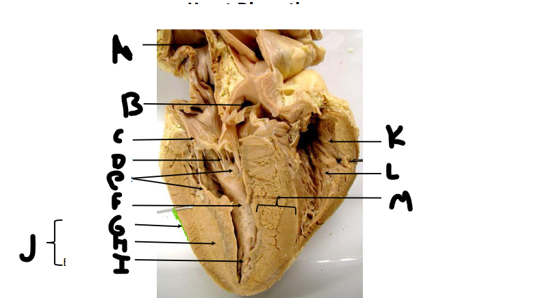 <p>D</p>