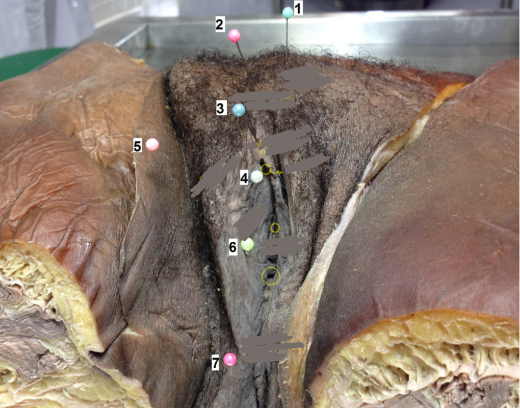 <p>Identifique a estrutura 6</p>