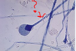 <p>What is this stalk like thing</p>